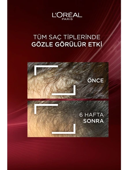 Elseve Komple Direnç Bakım Kremi 250 ml - Resim 3