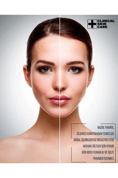 Ostwint Siyah Nokta ve Sivilce Karşıtı Yüz Temizleme Toniği 250 ml - 2