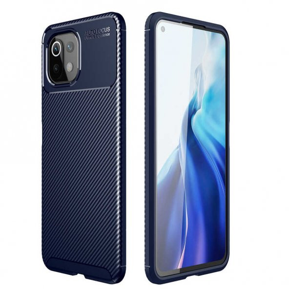 Xiaomi Mi 11 Lite Kılıf Zore Negro Silikon - 2