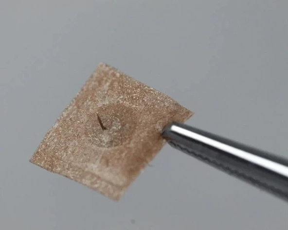 Shenlong Press Needle Kalıcı Kulak İğnesi 100 adet 0.22 x 2 mm S - Tek Flasterli - 4