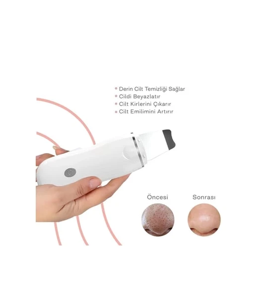 Ultrasonik Spatula Yüz Akne Giderici Siyah Nokta Temizleme Cihazı - Resim 4