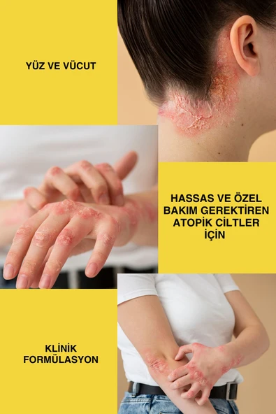 Sülfax Kükürt Vücut Kremi 100ml - 5