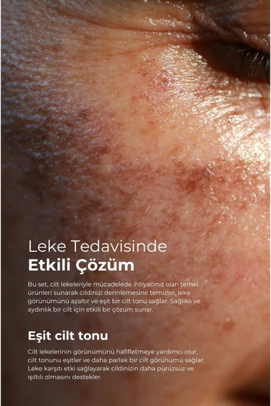 Tto Clinic Leke Kremi 75ml - Resim 4