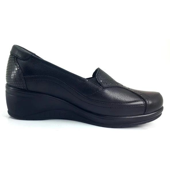 Forelli Rosa 25YA Kadın Anatomik Günlük Ayakkabı Siyah - Resim 3
