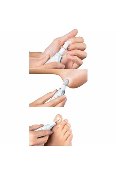 medikaltec Beurer MP 41 Manikür ve Pedikür Seti 7'li Beyaz - Resim 2