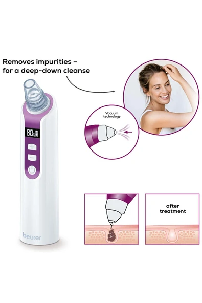 MEDİKALCİM Beurer FC 41 Gözenek Temizleyici - Resim 2