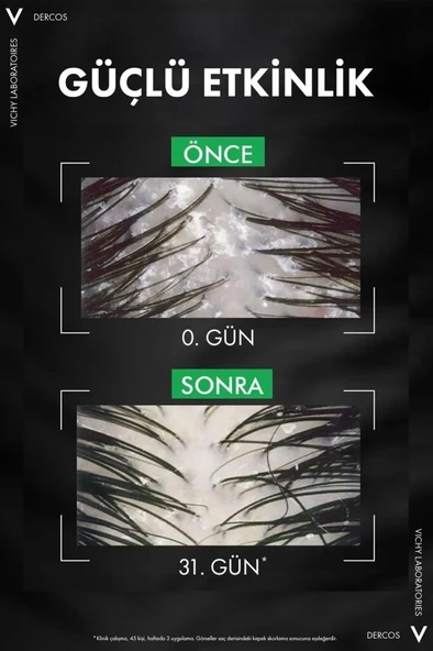 Vichy Dercos Kepek Şampuanı Kuru Saçlar 390 ML- REFİLL- 12M - 4