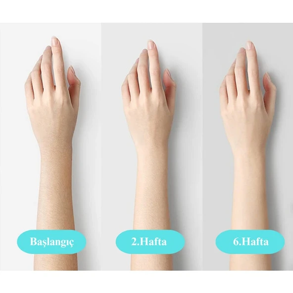 Yui IPLV15 Pro Vücut -Yüz- Bikini Başlıklı Ağrısız Otomatik ve Manuel Atım Buz Lazer Epilasyon Cihazı - 3