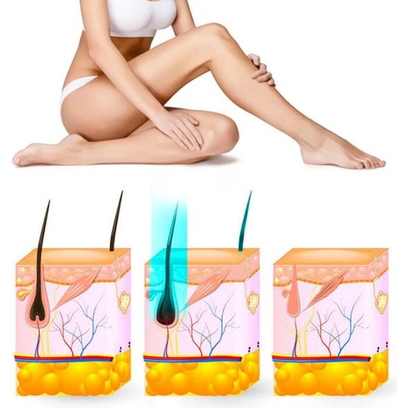 Yui IPLV15 Pro Vücut -Yüz- Bikini Başlıklı Ağrısız Otomatik ve Manuel Atım Buz Lazer Epilasyon Cihazı - 4