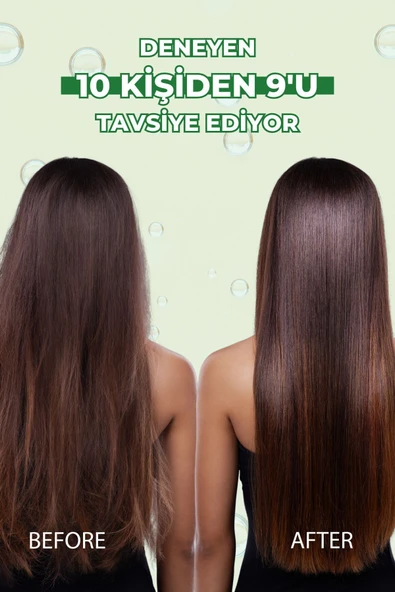 Zigavus Extra Plus Sarımsaklı Şampuan 150 ml - Yoğun Saç Dökülmesine Karşı  8699349130039 - 6