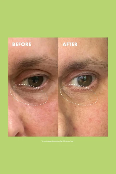 Kopari Niacinamide & Caffeine Aydınlatıcı Göz Kremi 15GR - 5