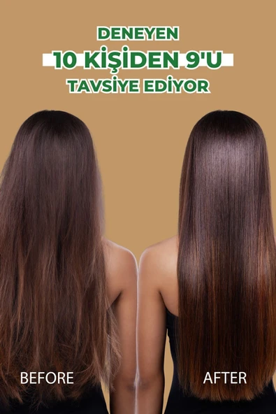 Zigavus Klasik Sarımsaklı Saç Dökülmesine Karşı Şampuan 3x250 ml - 6