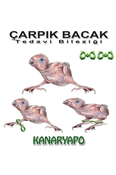 Muhabbet Çarpık Bacak Tedavi Bileziği No: 3-4 - Resim 2