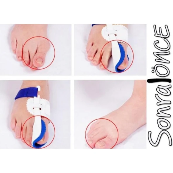 Baş Parmak Kemik Düzeltici Gece Ateli (Çift) - 2