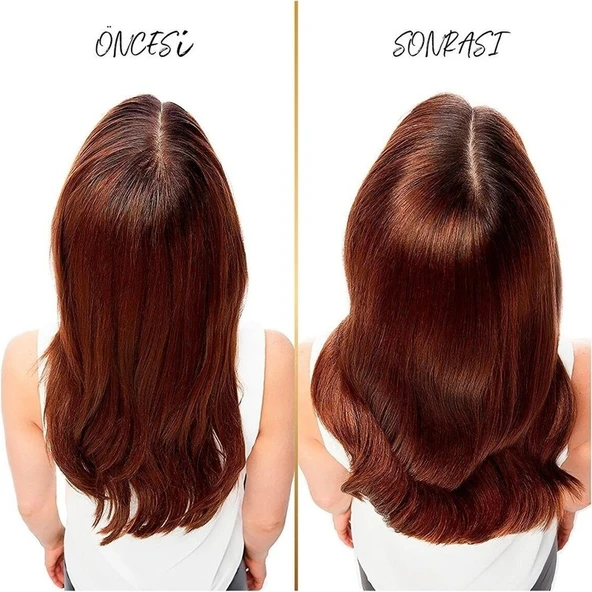 Pantene Şampuan 400 ml Kepeğe Karşı Şampuan 4 Adet Pantene Kepeğe Karşı 400 - Resim 3