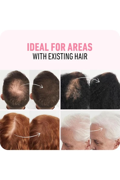 Boldify Saç Dolgunlaştırıcı Kapatıcı Fiber Toz Orta Kahverengi 12GR - Resim 5