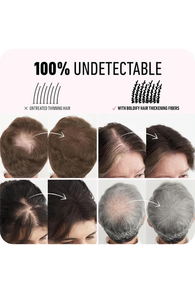 Boldify Saç Dolgunlaştırıcı Kapatıcı Fiber Toz Siyah 12GR - 6