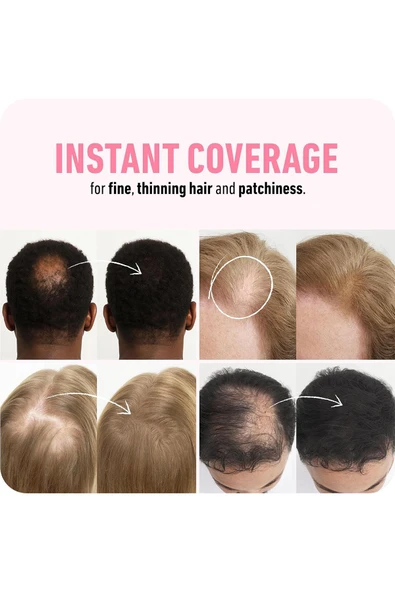 Boldify Saç Dolgunlaştırıcı Kapatıcı Fiber Toz Siyah 12GR - 4