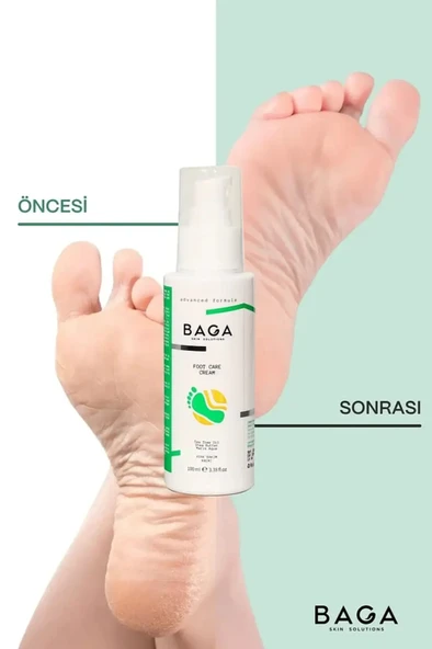 BAGA Yara ve Çatlak Onarıcı Topuk Ayak Bakım Kremi 100 ML - 4