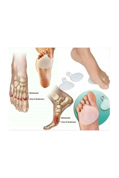 CMT Silikon Metatarsal Ped Ayak Altı Ağrı Nasır Koruma Parmağa Halka - 2