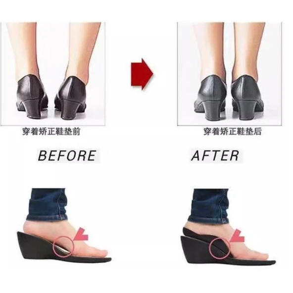 Esnek Düz Taban Düzeltici Topuk Yastığı 1 Çift - Resim 4