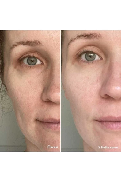 ORİFLAME NOVAGE+ LEKE AKNE VE YAŞLANMA KARŞITI BLEMİSH + AGE DEFY CİLT BAKIM SETİ - 8