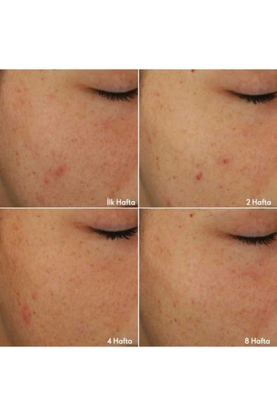 ORİFLAME NOVAGE+ LEKE AKNE VE YAŞLANMA KARŞITI BLEMİSH + AGE DEFY CİLT BAKIM SETİ - 4