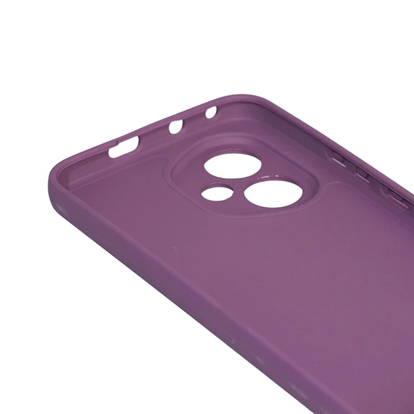 Honor 400 Kılıf Zore Biye Silikon - 8