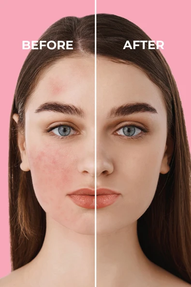 Sinoz Pink Touch Anında Ton Eşitleyici Onarıcı Nemlendirici Pembe Yüz Güneş Kremi Spf50 50 ml