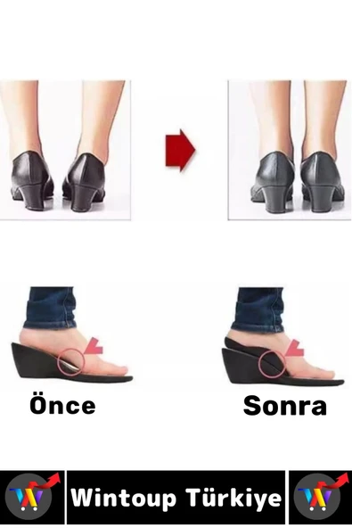 Unisex Gündelik Kullanım Konforlu Destekleyici Ayak Düz Taban Düzeltici Esnek Silikon Topuk Yastığı - 3