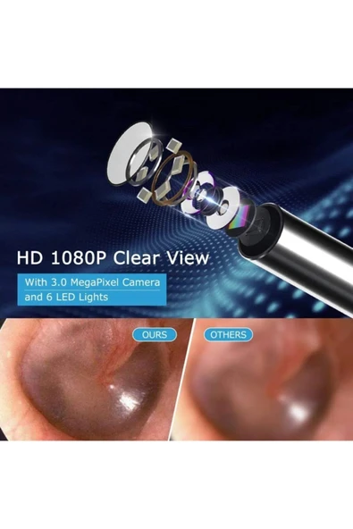 harry Kablosuz Hd Kameralı Kulak Temizleme Seti 360° açı 1296P Wifi Bağlantılı IOS ve Android Uyumlu - Resim 6