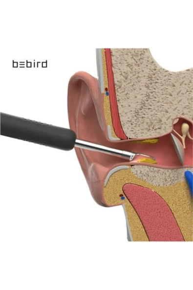 harry Kablosuz Hd Kameralı Kulak Temizleme Seti 360° açı 1296P Wifi Bağlantılı IOS ve Android Uyumlu - Resim 5