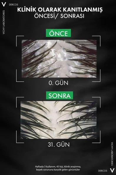 Vichy Dercos 2’si 1 Arada Kepek Karşıtı & Nemlendirici Şampuan 390ml - 3