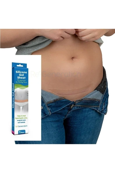 RE-GENERATION Silikon Sheet - Silikon Jel Tabaka -doğum Sonrası Izleri Giderir - Ameliyat Izleri 15x4,0x0,1 Cm - 4