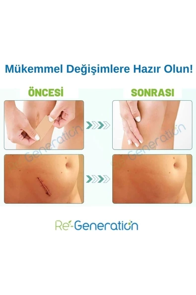 RE-GENERATION Silikon Sheet - Yara Bakımı, Yanık Izi, Ameliyat Izi, Akneizi Gidermeye Yardımcı - 9x2x0,1 Cm - 3