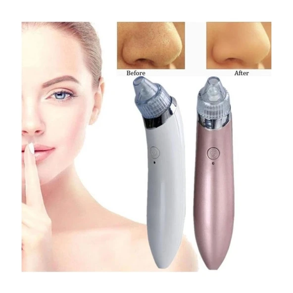 MUJGAN XN-8030 Profesyonel Vakumlu Siyah Nokta ve Temizleme Şarjlı