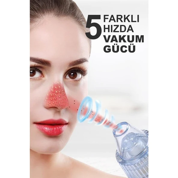 Dempower XN-8030 Şarjlı Vakumlu Yüz Temizleme Cihazı Siyah Nokta Temizleme Cihazı - 4