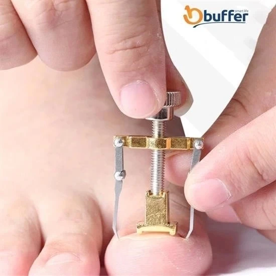Batan Tırnak Düzeltme Aleti Batık Tırnak Çıkarıcı Aparat - 4