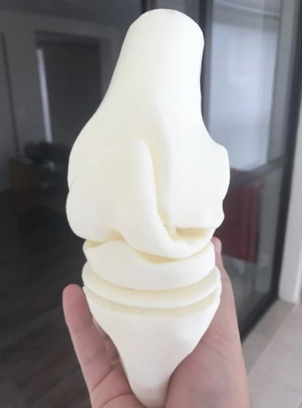 Diz Eklemi Modeli - Diz Eklemi Maketi - 3