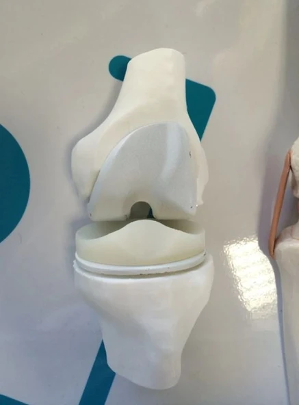 Diz Eklemi Modeli - Diz Eklemi Maketi - 2