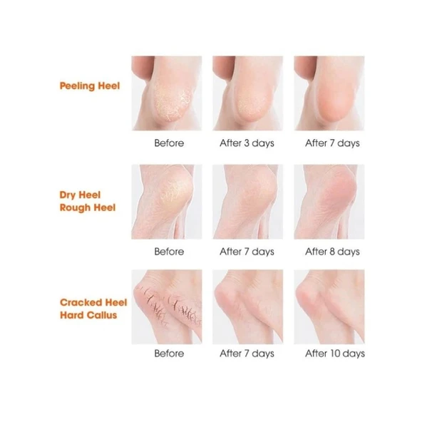 Silikon Topuk Nemlendirici Çorap - Resim 4