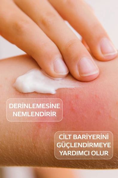 B-GOOD B-GOOD Atocare Vücut Kremi Çok Kuru Ve Atopik Ciltler Için Yoğun Nemlendirici Bebek Çocuk Yetişkin 150 ml - 2
