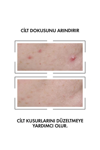 VİCHY VİCHY Normaderm Probio Bha Peeling Etkili Cilt Kusuru Karşıtı Serum 30 ml - 2