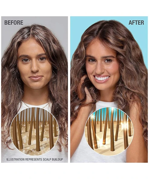 Neutrogena Healthy Scalp Hydro Boost Hyaluronic Şampuan 354 ML - 3