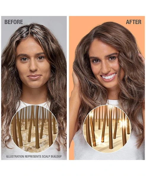 Neutrogena Healthy Scalp Clarify&Shine Şampuan 354 ML - Resim 3