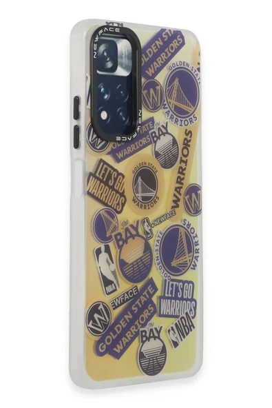 Xiaomi Redmi Note 11 Pro Kılıf Estoril Desenli Kapak - Estoril - 13 - Resim 3