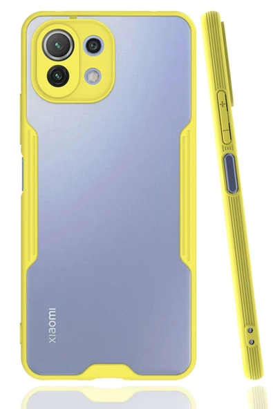 Xiaomi Mİ 11 Lite Kılıf Platin Silikon - Sarı ürün görseli