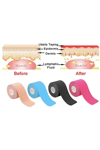 FİZYOPOL FİZYOPOL New Product Kinezyo Tape Band 5 Metre X 5 Cm Mavi Renk Kinesio Sporcu Bandı - Resim 6