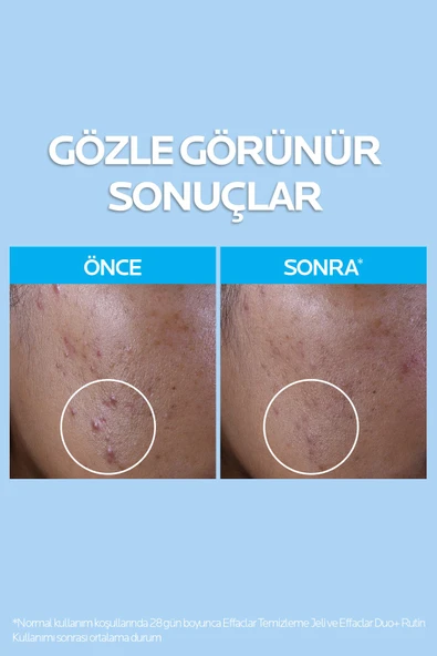LA ROCHE POSAY Effaclar Temizleme Jeli 400ml Yağlı Ve Akneye Eğilim Gösteren Ciltler - 4