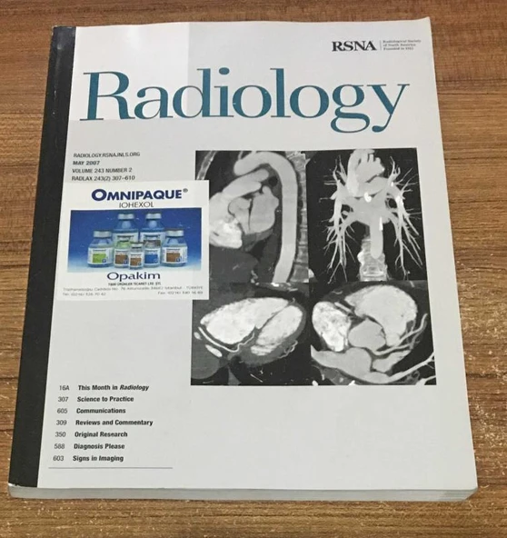 Radiology MAY 2007 Volume 243 Number 2 (Sahafiye Kitap) ürün görseli 1
